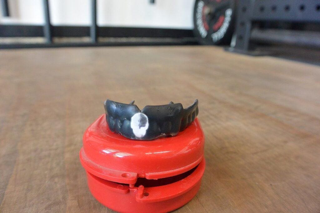 Impact customFIT Mouthguard - 1+ Year Review